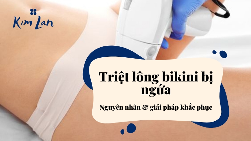 Triệt lông bikini bị ngứa