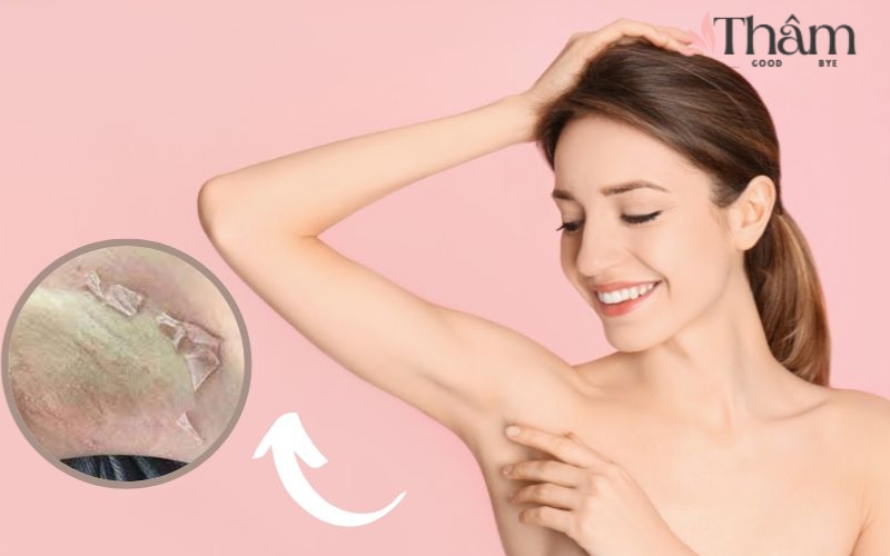 hướng dẫn cách sử dụng kem idoll
