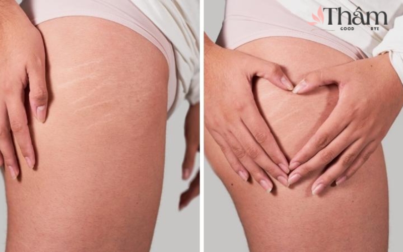Cần kiên trì sử dụng