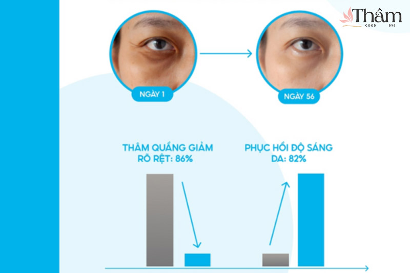 đánh giá thực tế trị thâm Uriage