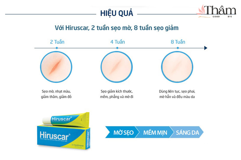 Hiệu quả của kem Hiruscar