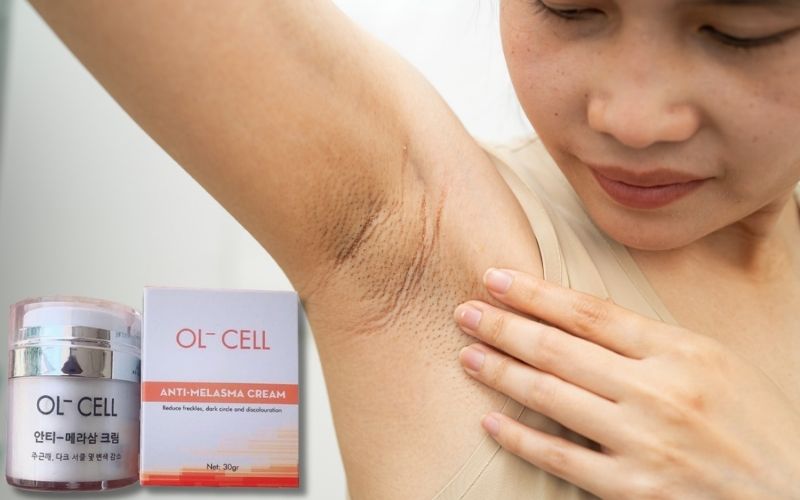 kem ol cell trị thâm