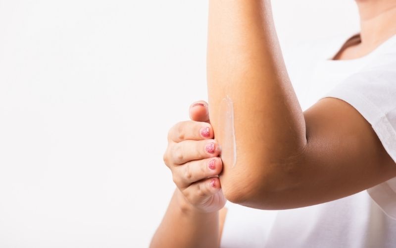 kem ol cell trị thâm