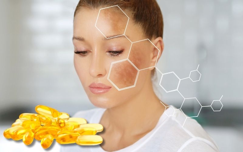 kem trị thâm dầu cá