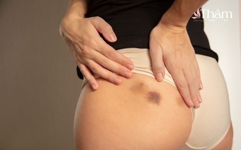 Spa trị thâm mông