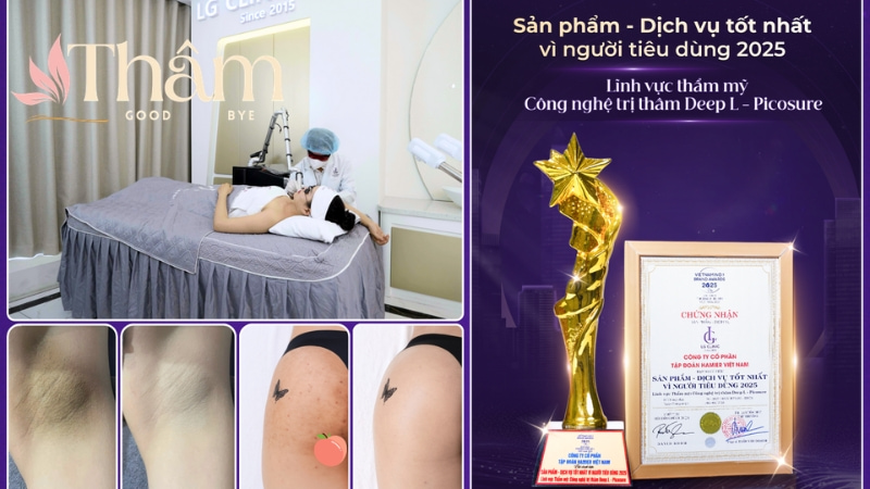 Trải nghiệm công nghệ Laser Picosure đánh bay sắc tố thâm cứng đầu, an toàn, không xâm lấn tại LG Clinic Tân Bình