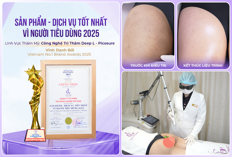 Công nghệ trị thâm của LG Clinic